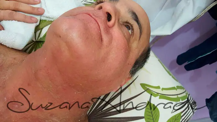 Rosto e pescoço na depilação masculina