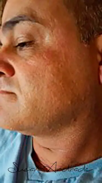 Pescoço e rosto depois da depilação masculina